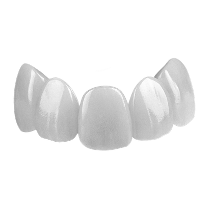 Виниры для зубов