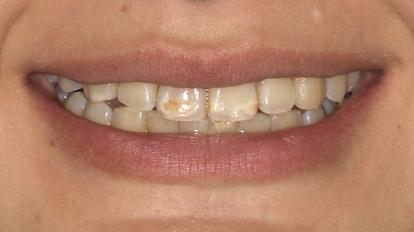 Без названия.001