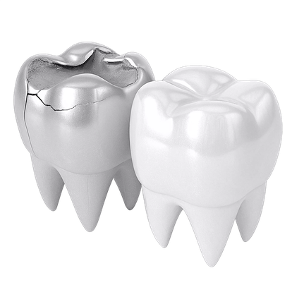 лечение зубов